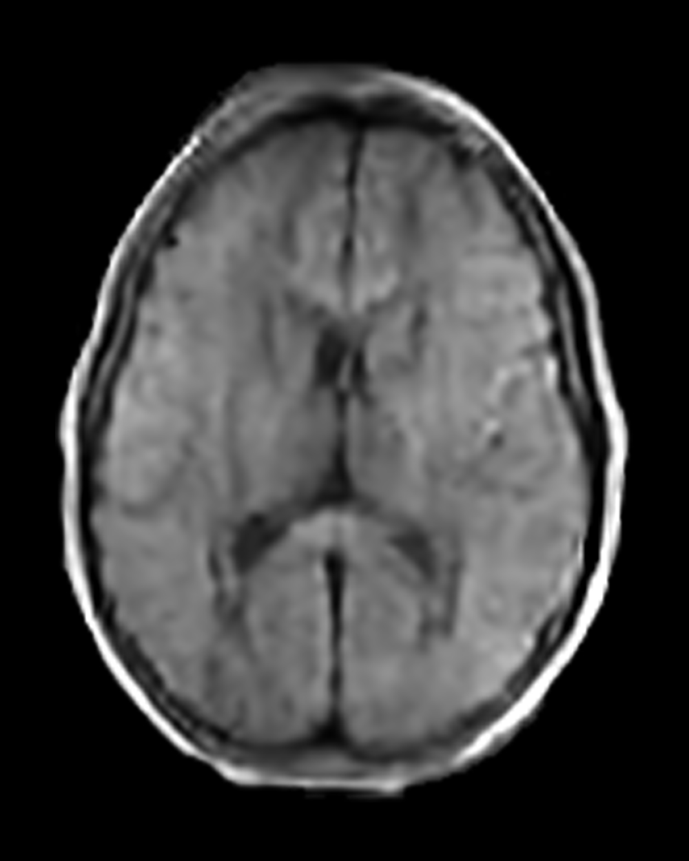 Single-Direction, Fast DWI