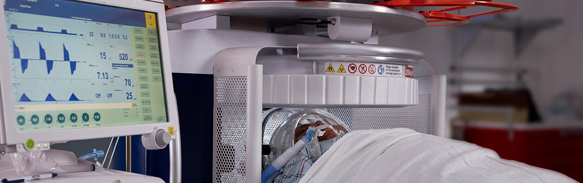 Portable MR Brain Imaging in&nbsp;ICUs