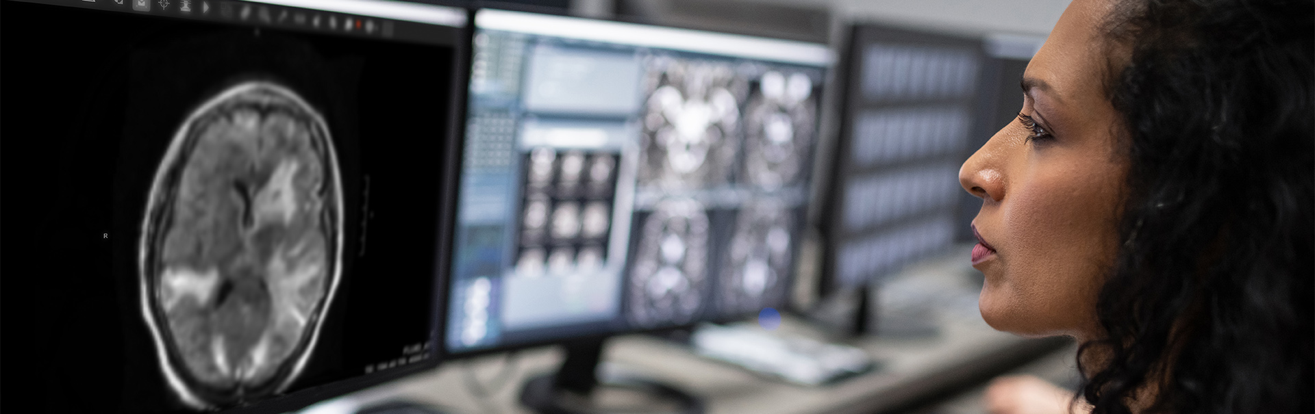 Portable MR Brain Imaging and&nbsp;Radiology