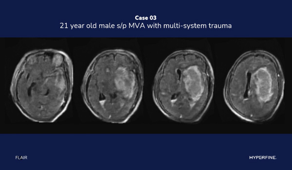 Hyperfine, Inc. 2023 ASNR Clinical Update: Case Image Quiz