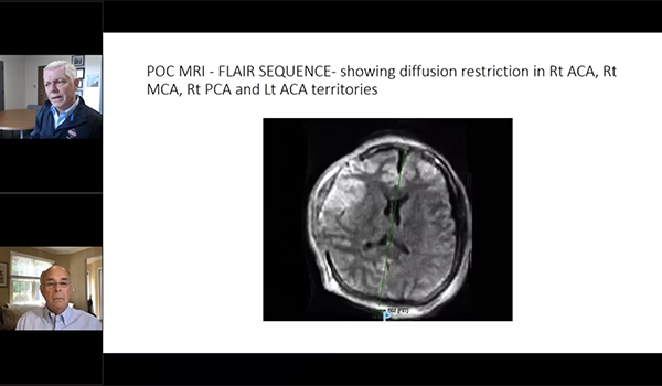 Implementing Low-Field, Point-of-Care MR Imaging in Critical Care